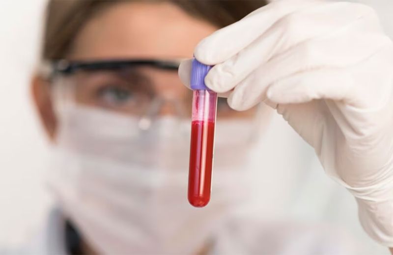 Intrinsic Genomics DNA Test