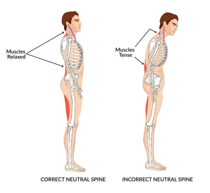 Correct neutral spine