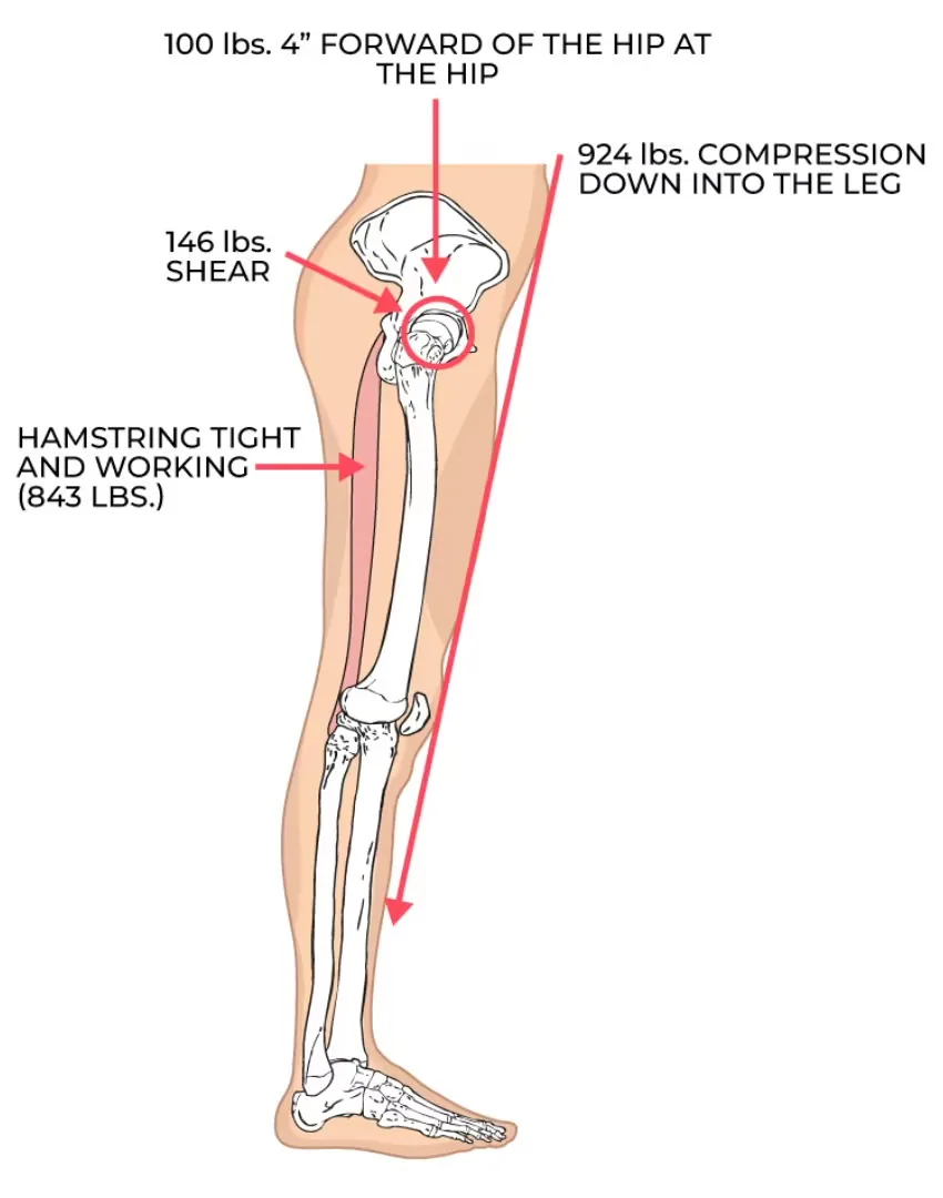 Hamstring diagram with forward posture and high shear