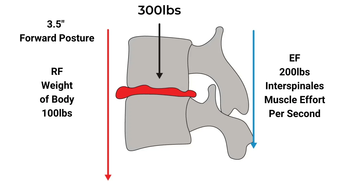 Low back diagram showing bad posture with high compression and effort