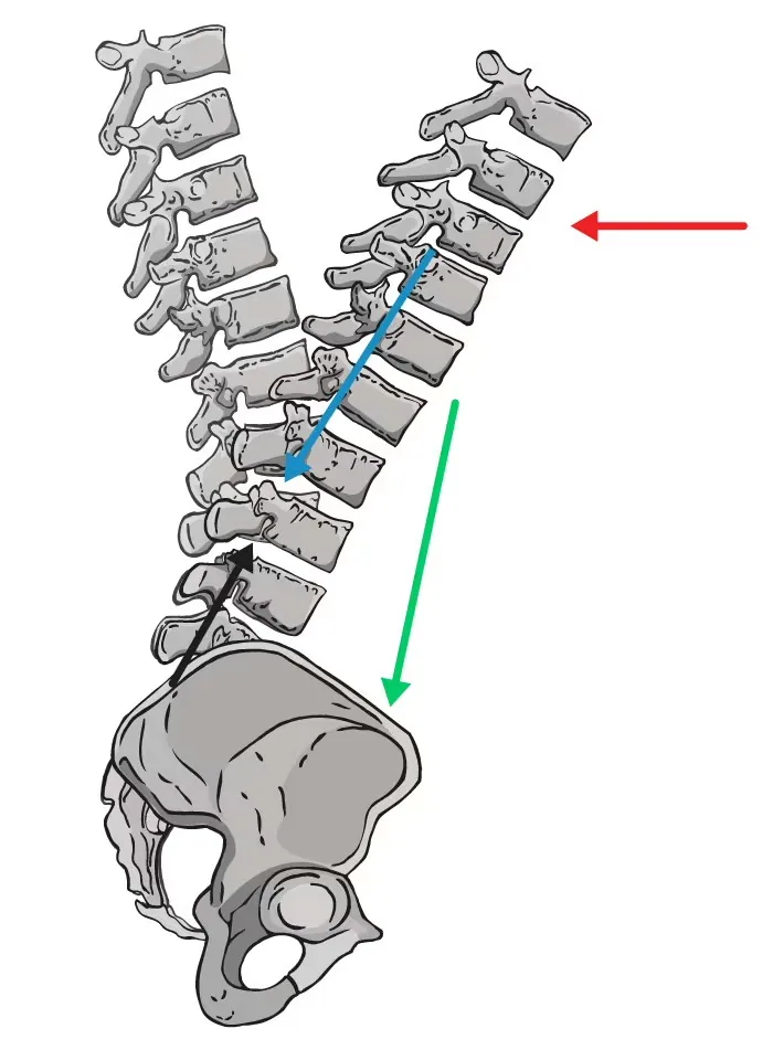 Spinal diagram with forces aligned in good posture
