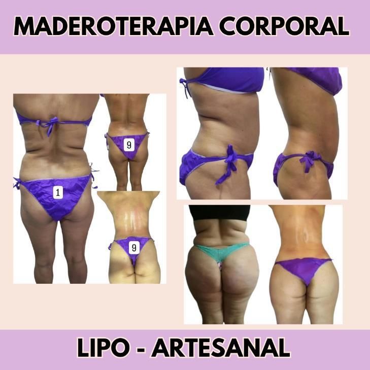 Maderoterapia Corporal