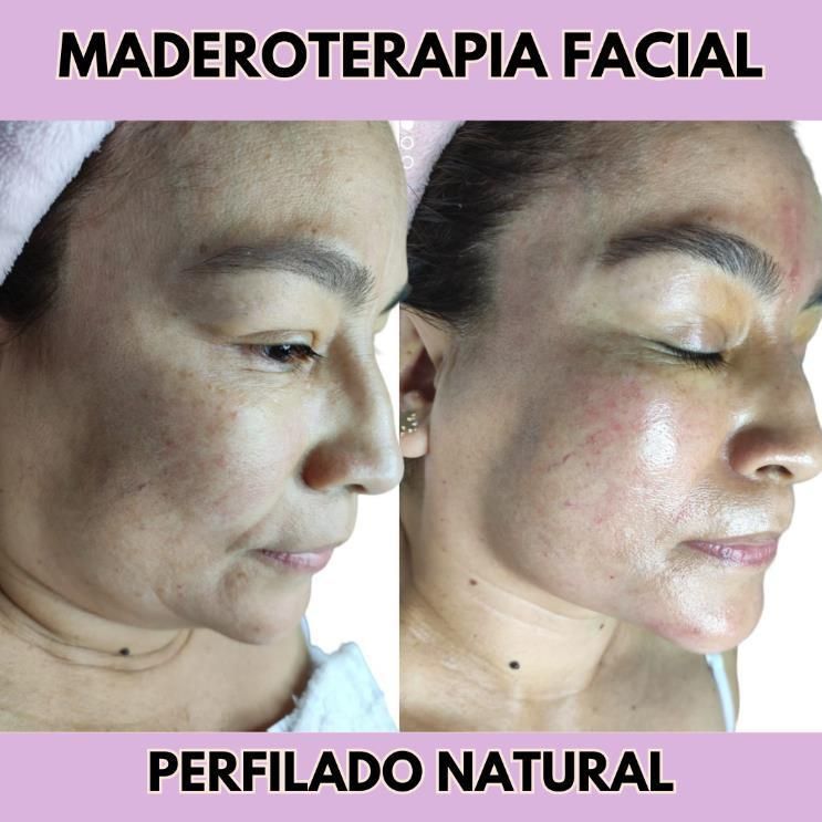 Maderoterapia Facial