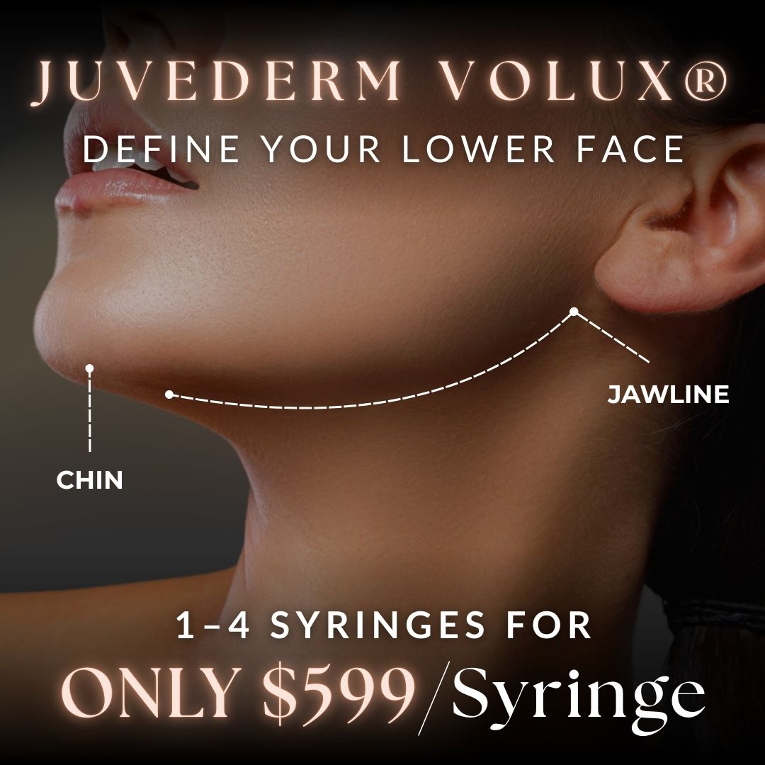 Juvederm Volux | ONLY $599/Syringe