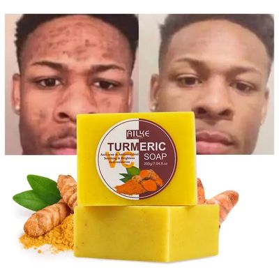 Savon nettoyant, éclaircissant, anti-acné au curcuma pour peau noire visage et corps
