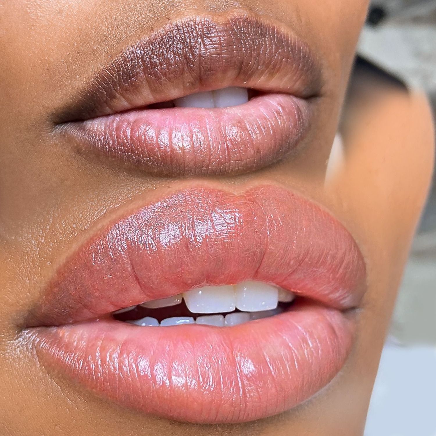 Lips Neutralization