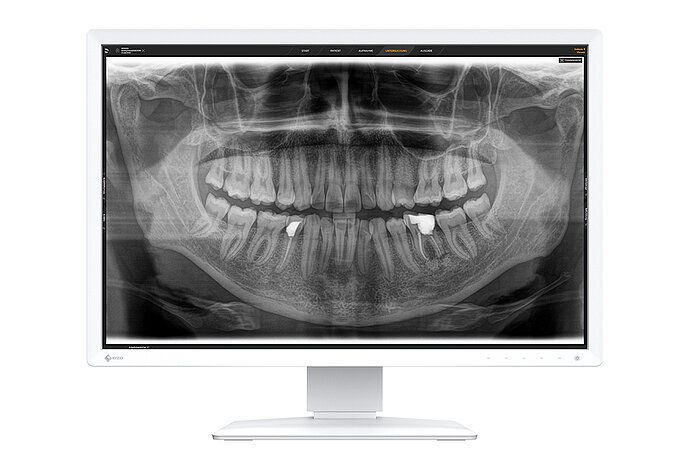 Befundungs-Monitor, z.B. Eizo MX243W-DT - 24&quot;