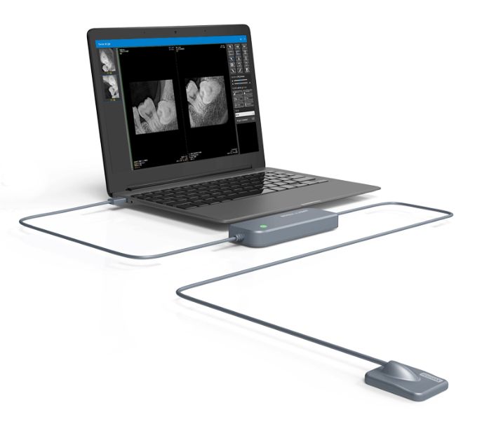 Xpect Vision Intraoral Sensor - 2 Größen, XVD2121 PLUS - XVD 2530