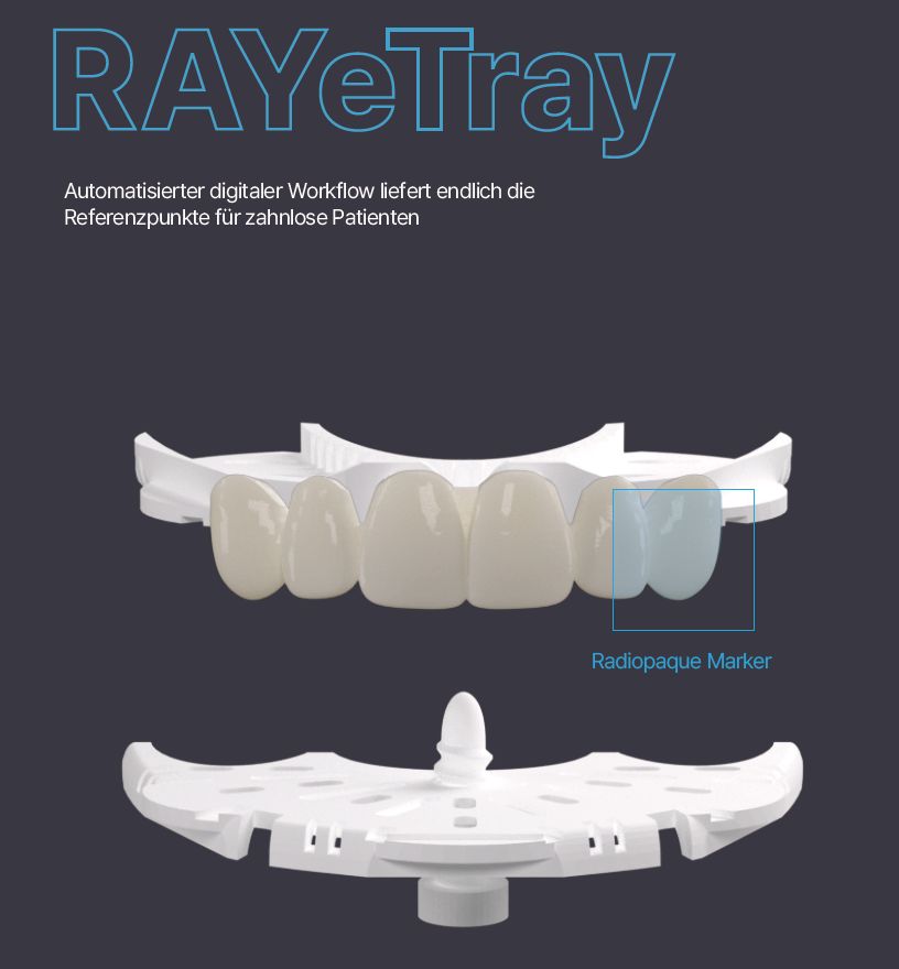 RAY etray - effiziente Erfassung von zahnlosen Kiefern mit RAYFace