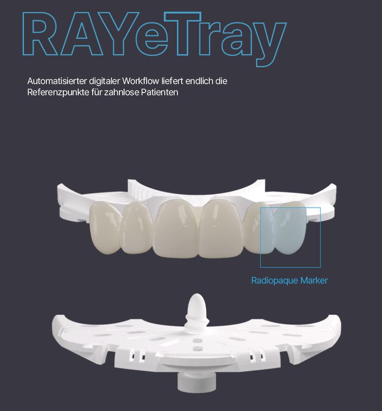 RAY etray - effiziente Erfassung von zahnlosen Kiefern mit RAYFace