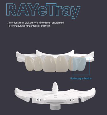 RAY etray - effiziente Erfassung von zahnlosen Kiefern mit RAYFace