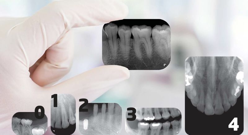 RIOScan RPS500 - Speicherfolien - Größen 0 bis 4 - bitte wählen