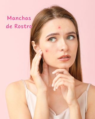 Manchas