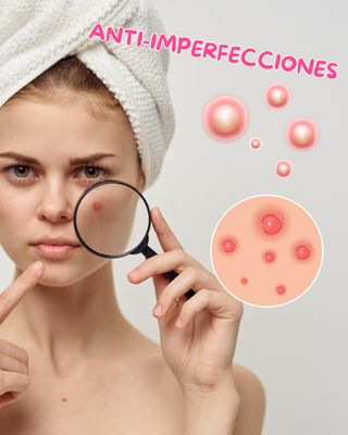 Anti-Imperfecciones