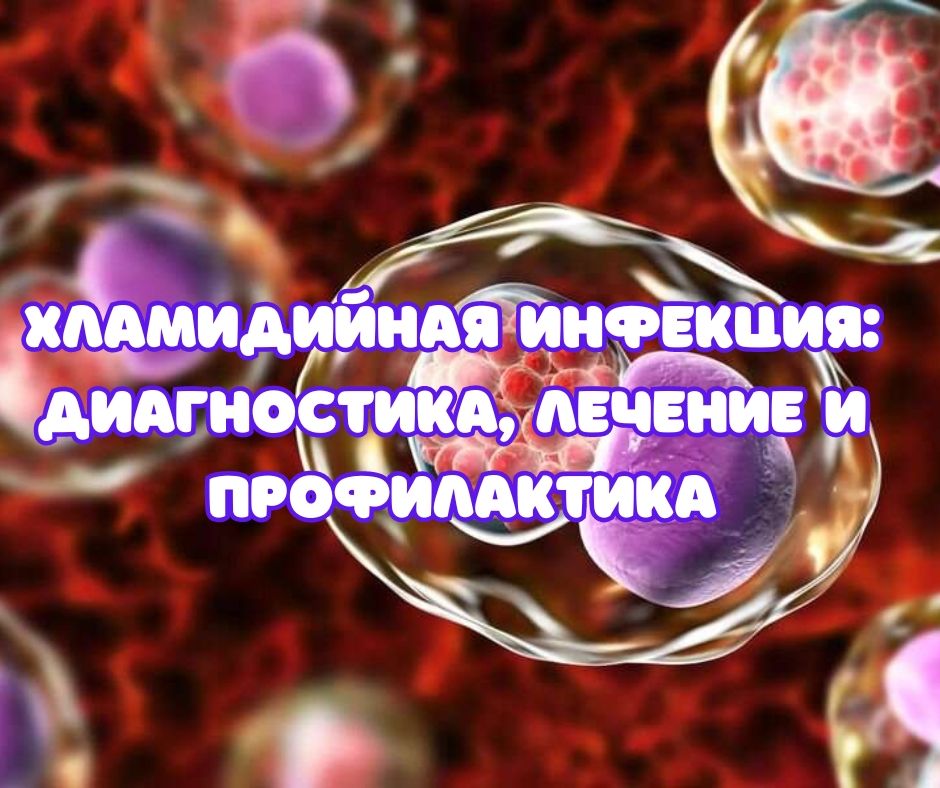 Хламидийная инфекция (АУДИО)