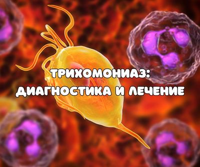 Трихомониаз: диагностика и лечение (АУДИО)