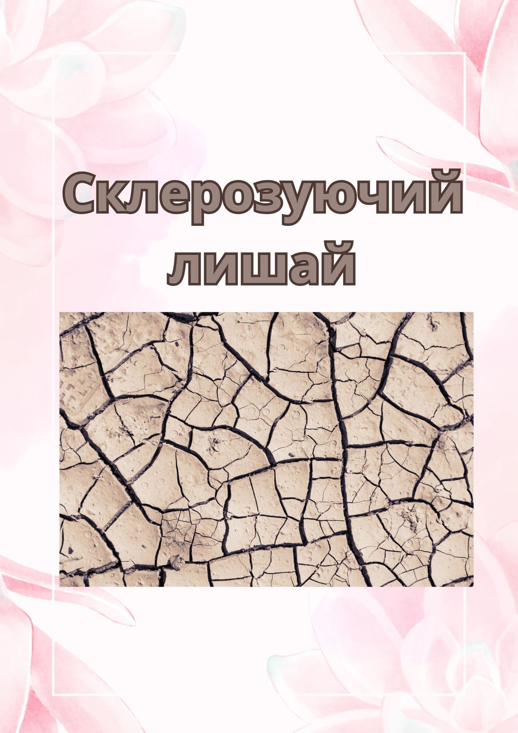 Склерозуючий лишай