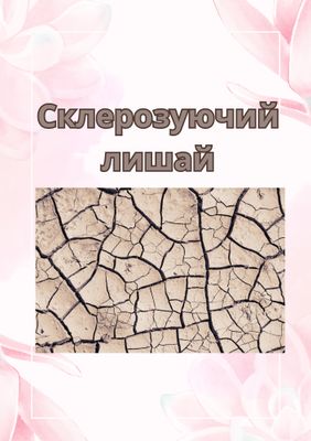 Склерозуючий лишай
