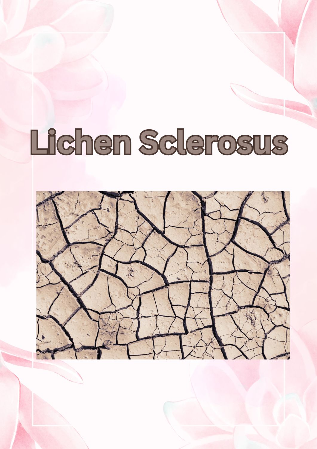 Lichen Sclerosus
