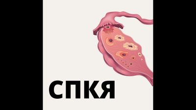 СПКЯ - приговор или коммерция (АУДИО)