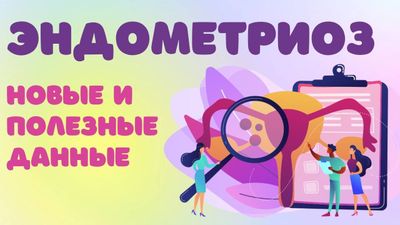 Эндометриоз — новые и полезные данные (АУДИО)