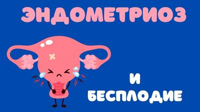 Эндометриоз и бесплодие (АУДИО)