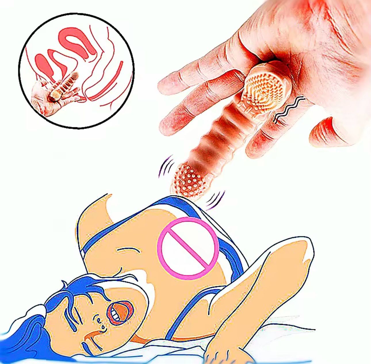 اصبع رجاج  داخلي خارجي