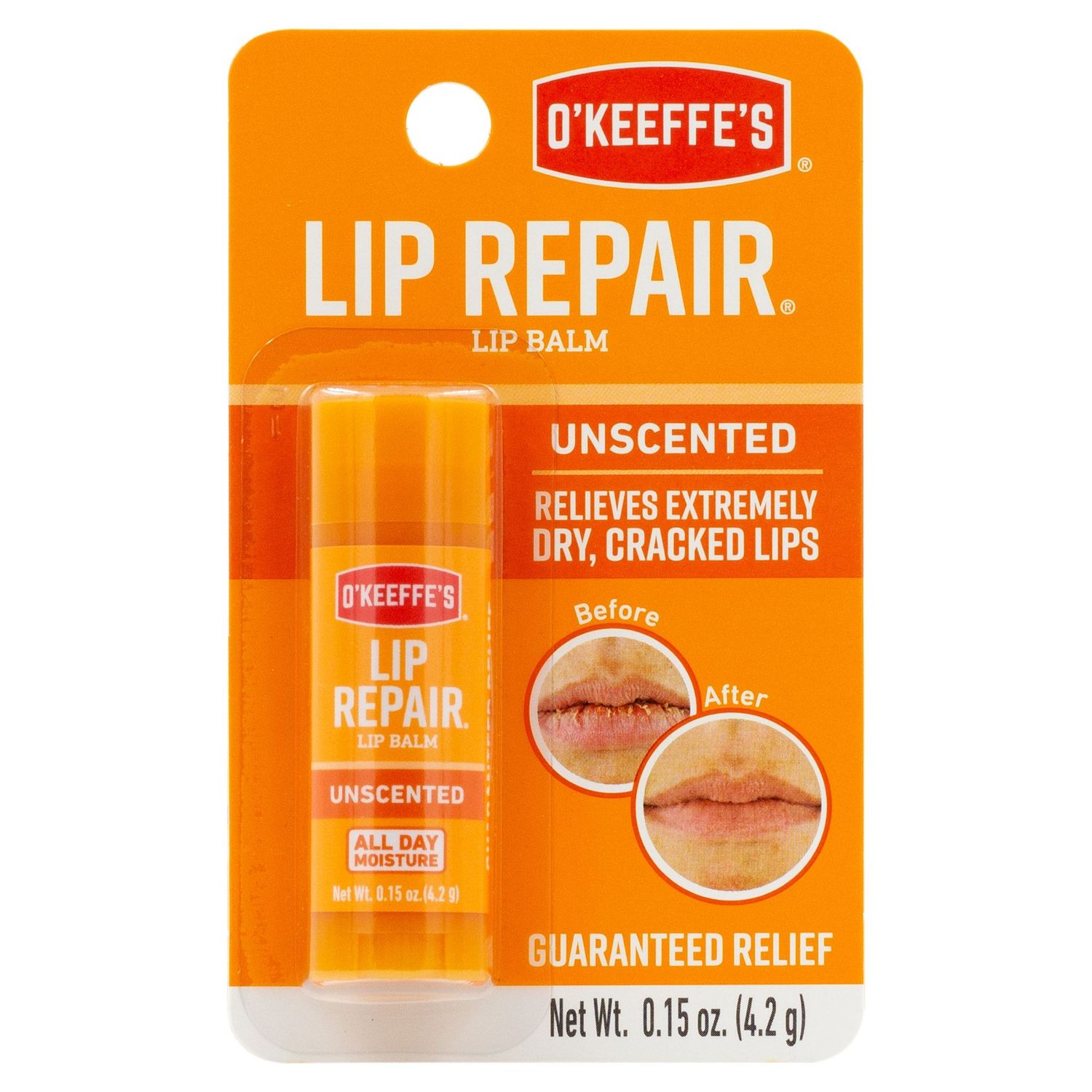 Lip Repair