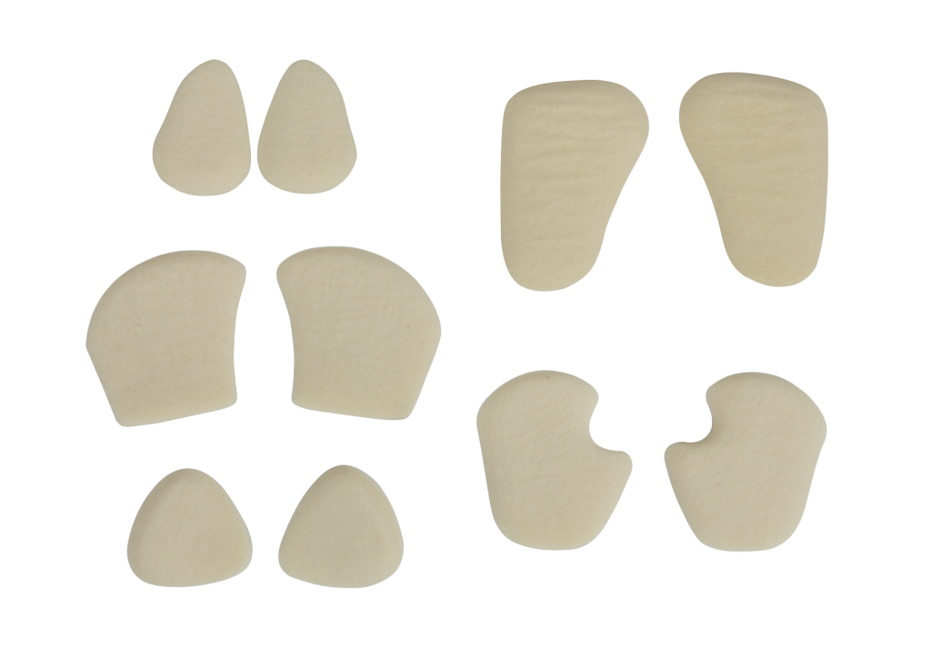 Removable Inlay With Hapad