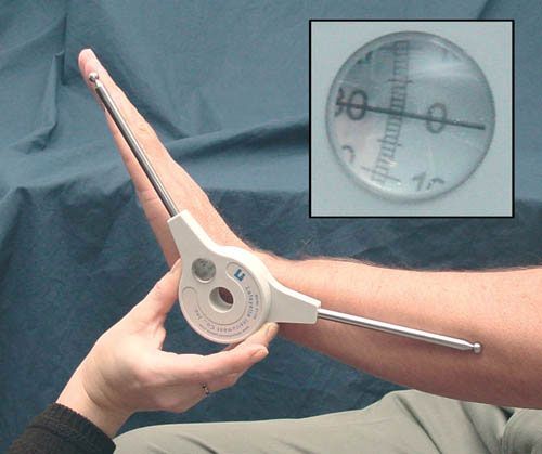 Extendable Goniometer Extendable Goniometer