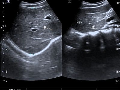 Ultrasound Examination Second Opinion