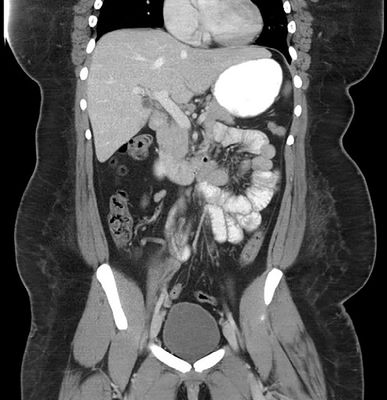 CT Scan Examination Second Opinion
