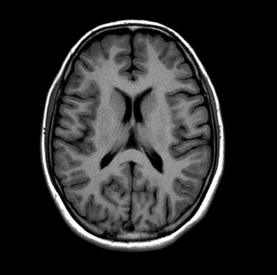 MRI Examination Second Opinion