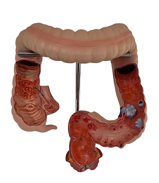 Anatomisches Modell &quot;Darm&quot;