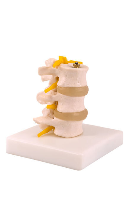 Anatomisches Modell &quot;3 Wirbelkörper&quot;