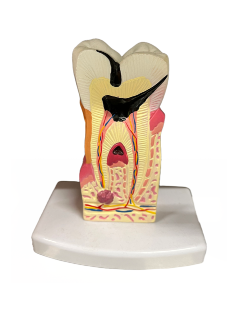 Anatomisches Modell &quot;Zahn&quot;