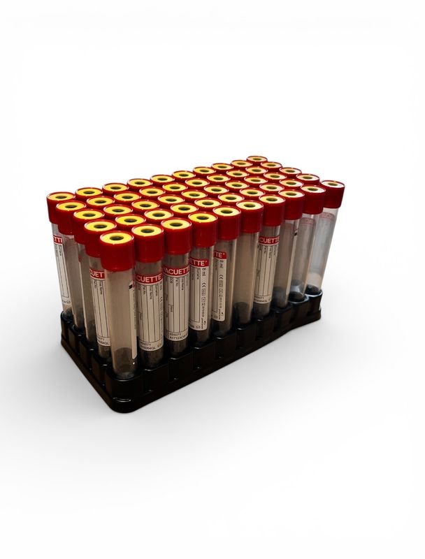 Probenröhrchen im Ständer rot/gelb