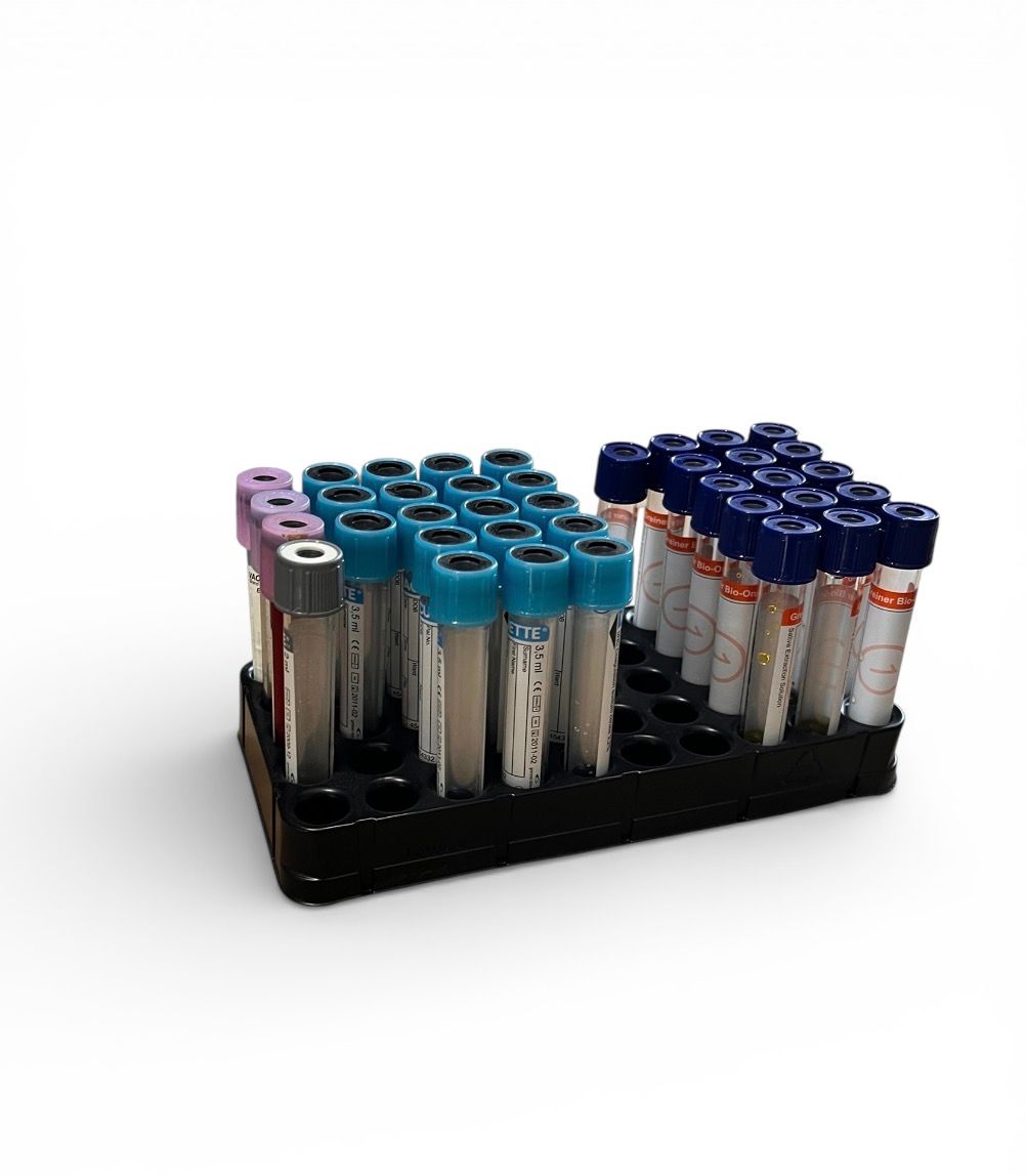 Probenröhrchen Mix im Ständer