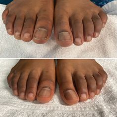 Pedicure