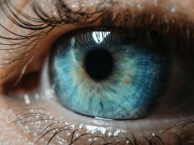 Vision
