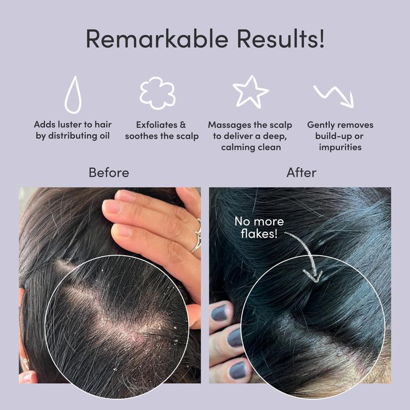 Jupiter Exfoliator Brush For Removing Dandruff &amp; Build-Up - Detangling Scrubber For Wet or Dry Hair - Supports Circulation &amp; Growth - For All Hair Types - Black