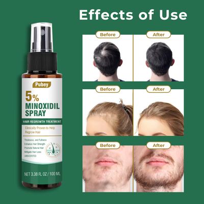 Pugbey 5% Minoxidil for Men, Minoxidil Spray for Women Hair Growth, Beard and Hair Growth Serum, Regrowth Treatment, 3.38 Fl Oz, 2 Month Supply