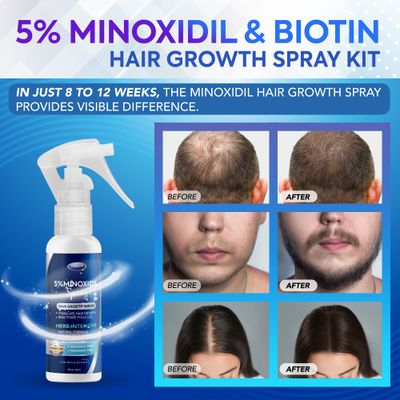 5% Minoxidil Spray for Hair &amp; Beard Growth, Hair Regrowth,Hair Loss Treatments for Men &amp; Women 60ml  3bottles