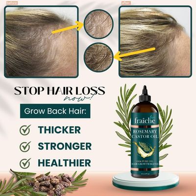 Live Fraiche Rosemary Castor Oil for Hair Growth Oil (16oz) Natural Hair Growth Serum - Pure Castor Oil with Rosemary Oil for Hair Growth and Thickening - Reduce Hair Loss & Promote a Healthy Scalp