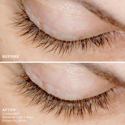 Contours Rx Botanical Lash and Brow Serum - Enhancing Eyebrow Growth &amp; Eyelash Serum with Biotin Oil, Hyaluronic Acid Peptides &amp; Plant Stem Cells - Stronger, Thicker &amp; Fuller Lashes (5 ml)