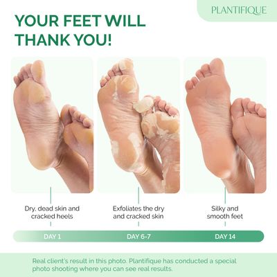 PLANTIFIQUE Foot Peeling Mask (2 Pairs) - Peeling Foot Mask Dermatologically Tested Repairs Heels &amp; Removes Dry Dead Skin for Baby Soft Feet - Exfoliating Foot Peel Mask for Dry Cracked Feet (Peach)