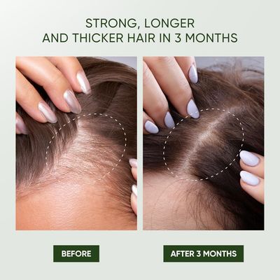 Svvimer Rosemary Hair Growth Shampoo - Thickening Shampoo with Biotin Tea Tree Oil for Hair Loss and Thinning Hair - Sulfate Free for Women and Men 11.8 Fl Oz (Pack of 1)