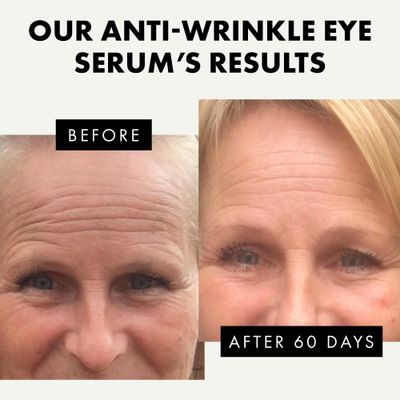 Eye Serum - Under Eye Cream for Dark Circles and Puffiness - Anti Aging Eye Cream, Under Eye Brightener Eye Bags Eye Treatment, Caffeine Eye Cream Puffy Eyes Treatment Dark Circle