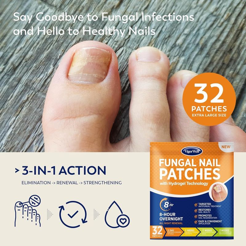 Toenail Fungus Treatment Extra Strength - Nail Fungus Treatment For Toenail Toe Nail Fungus Treatment Extra Strength - Nighttime Fungal Nail Patches &amp; Fungus Nail Treatment Liquid Set (32patches15ml)