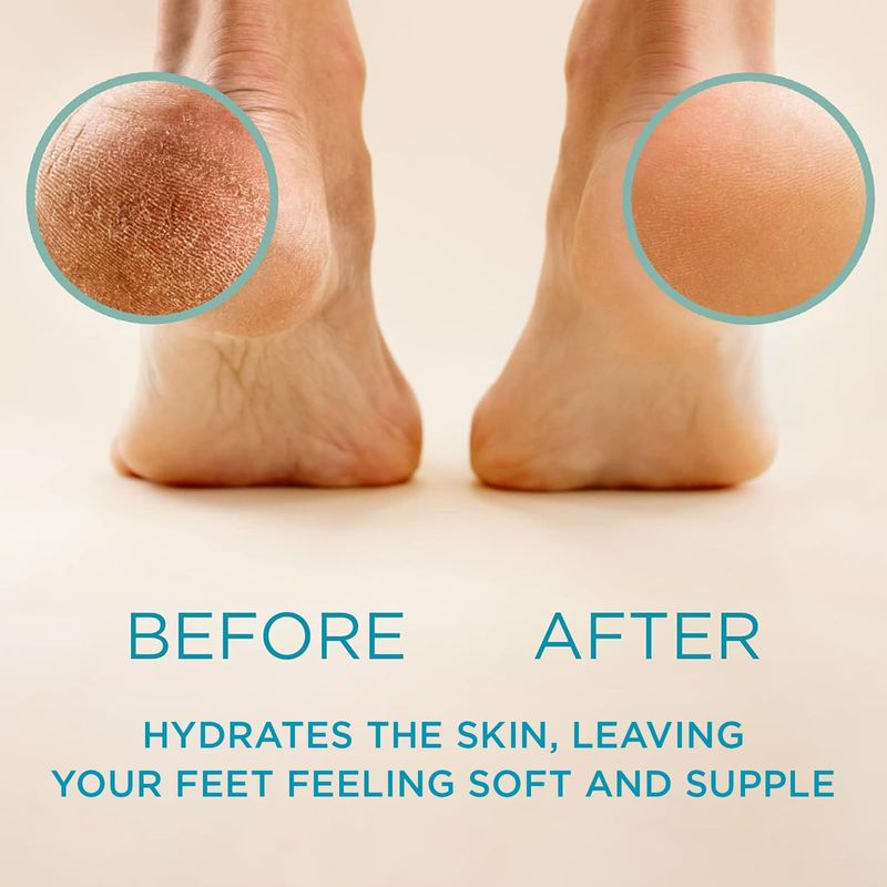 Lee Beauty Professional Callus Remover for Feet - Extra Strength Gel &amp; Rasp Foot File Kit - Original Formula for Dead Skin Remover for Cracked Heels &amp; Dry Skin-Pedicure Supplies for Smooth Foot - 8 Oz